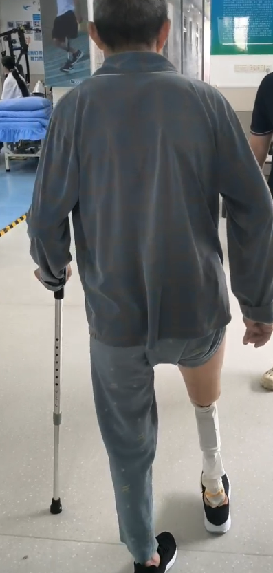 糖味暖阳里，宾路假肢让他重新站了起来