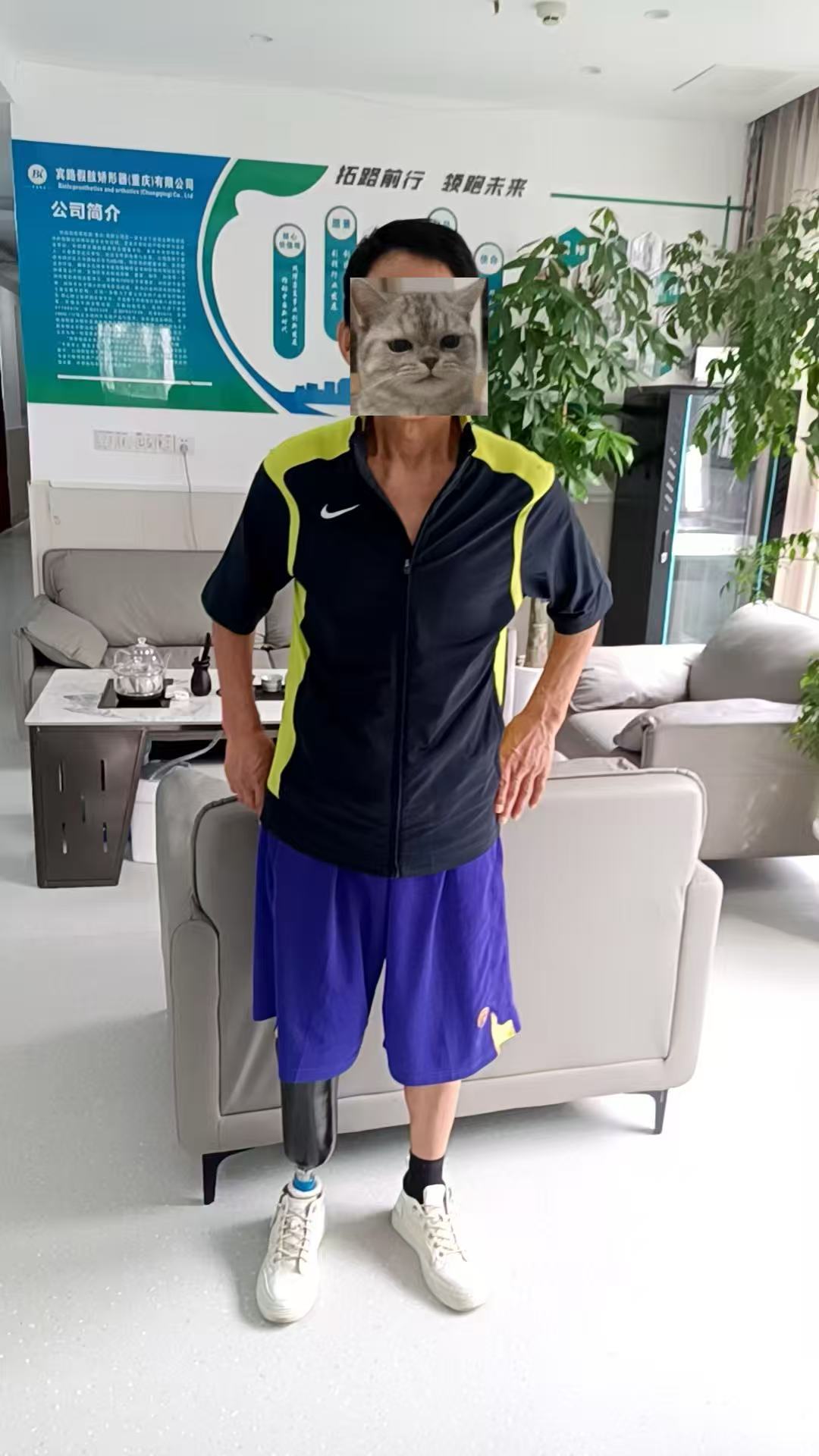 宾路假肢：以真诚与专业，助孙爷爷重燃生活希望!